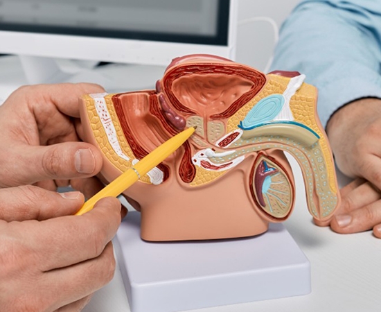 Hiperplasia de Próstata